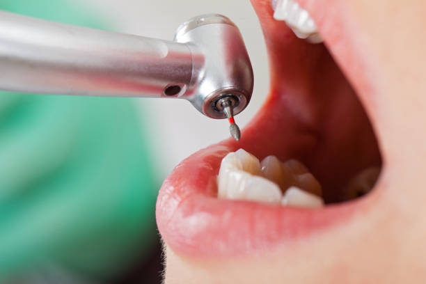 Best Emergency Treatment for Toothache in Annandale, NJ